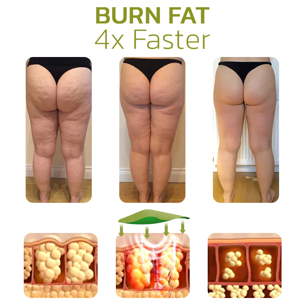 Glättende Cellulite-Reduktionscreme für seidige Haut