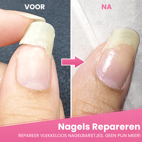Reima™ | Reparaturgel für rissige Nägel