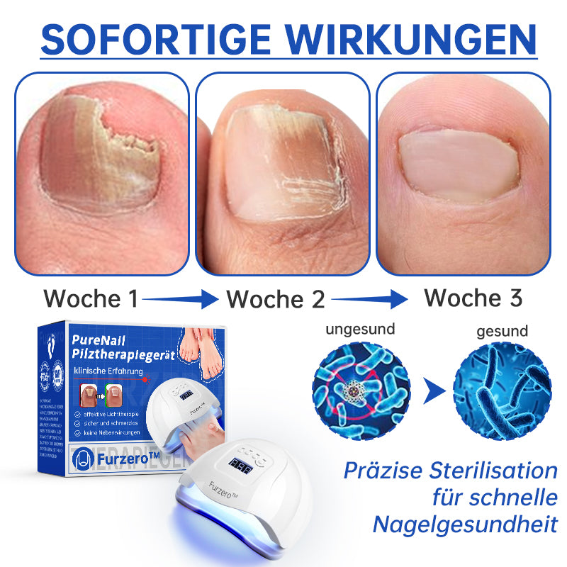 PureNail™ | Nagelpilz-Lasertherapiegerät