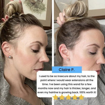 Hochfrequenz-Gesichtsgerät für strahlende Hautpflege