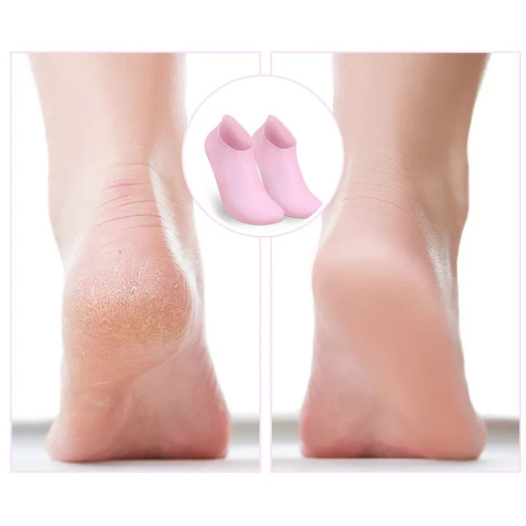 SilkSole – Beginnen Sie Ihren Tag mit weichen, hydratisierten, rissfreien Füßen jeden Morgen