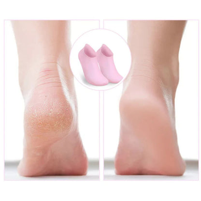 SilkSole – Beginnen Sie Ihren Tag mit weichen, hydratisierten, rissfreien Füßen jeden Morgen