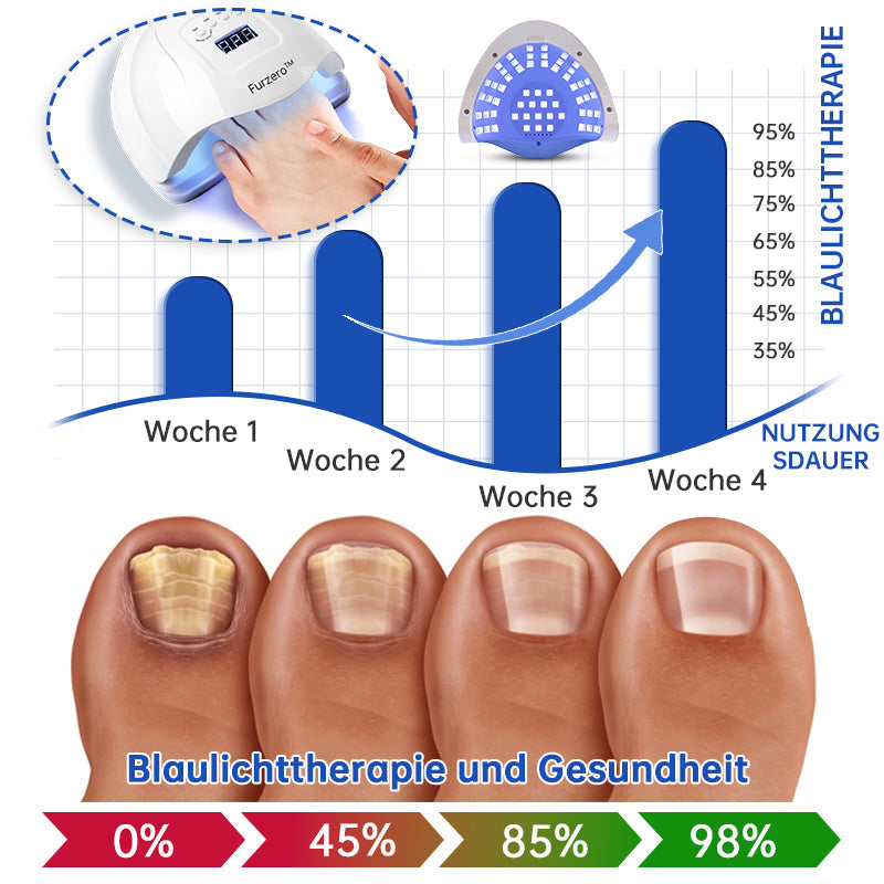 PureNail™ | Nagelpilz-Lasertherapiegerät