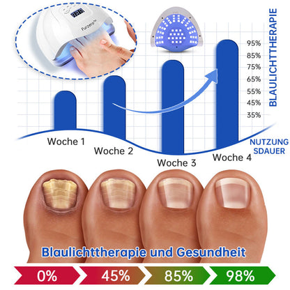 PureNail™ | Nagelpilz-Lasertherapiegerät