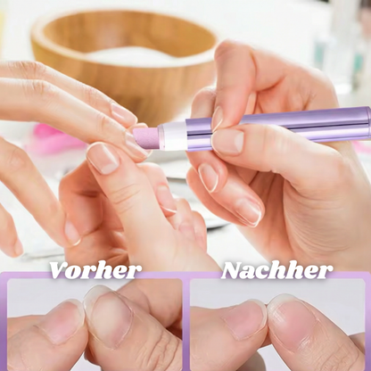 1+1 GRATIS | Nairoel™ - Stift zur Pflege von abgestorbener Haut und Nagelhaut [Lezter Tag Rabatt]