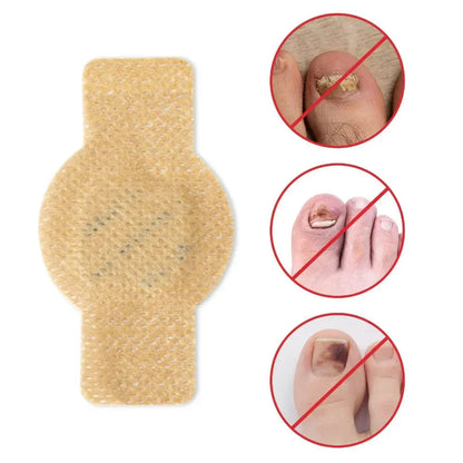 FungiCare™ - Einfach Anzubringende Nagelreparaturpflaster
