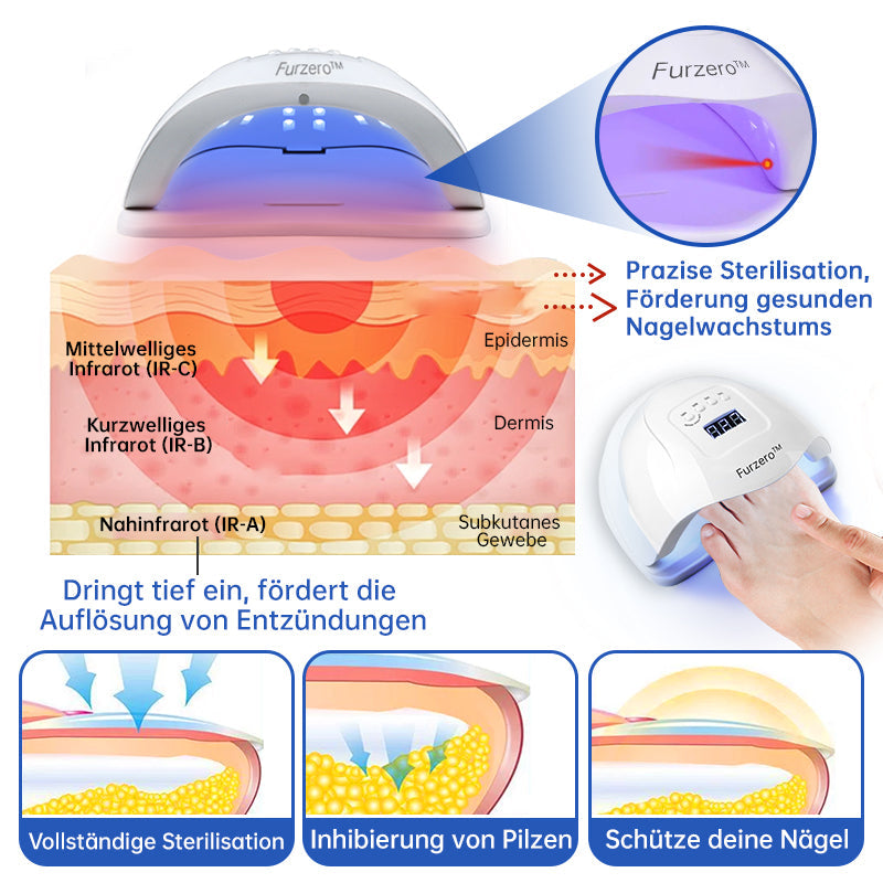 PureNail™ | Nagelpilz-Lasertherapiegerät
