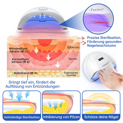 PureNail™ | Nagelpilz-Lasertherapiegerät