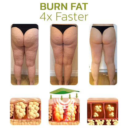 Glättende Cellulite-Reduktionscreme für seidige Haut