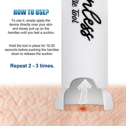 ItchAway™ – Tragbares Soforthilfe-Gerät gegen Bisse und Stiche