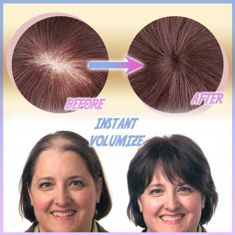 LusailStore™ - Magischer Clip-On Haaraufsatz