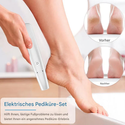 50% RABATT | ClearFeel™ - Elektrischer Hornhautentferner für seidig glatte Füße [Lezter Tag Rabatt]