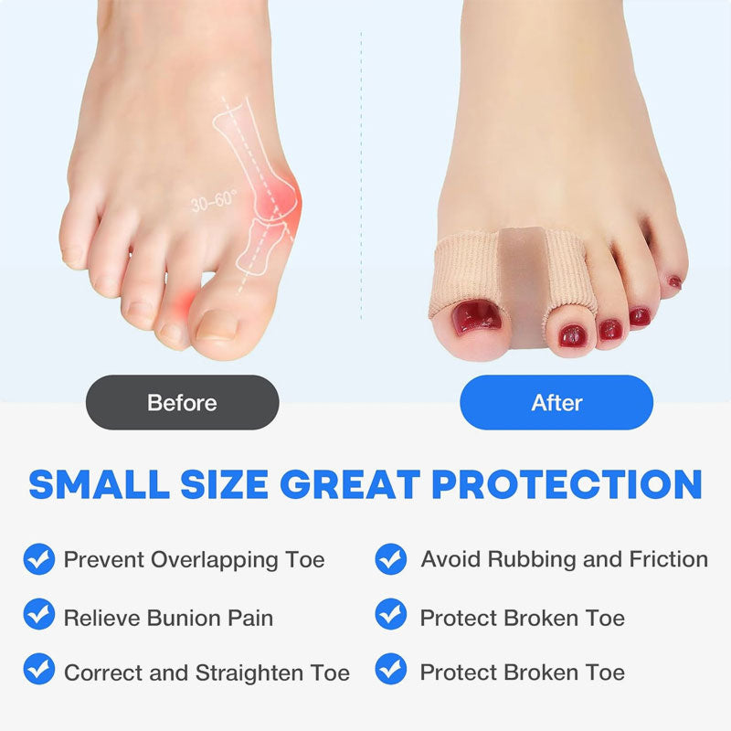 FlexiStep™ - Bequemer Zehenkorrektur-Sleeve