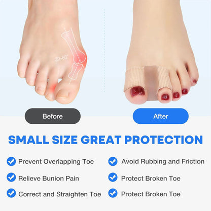 FlexiStep™ - Bequemer Zehenkorrektur-Sleeve