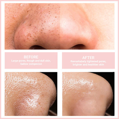 GlowPure™ - Sanftes Gesichtsreinigungsgerät für strahlende Haut